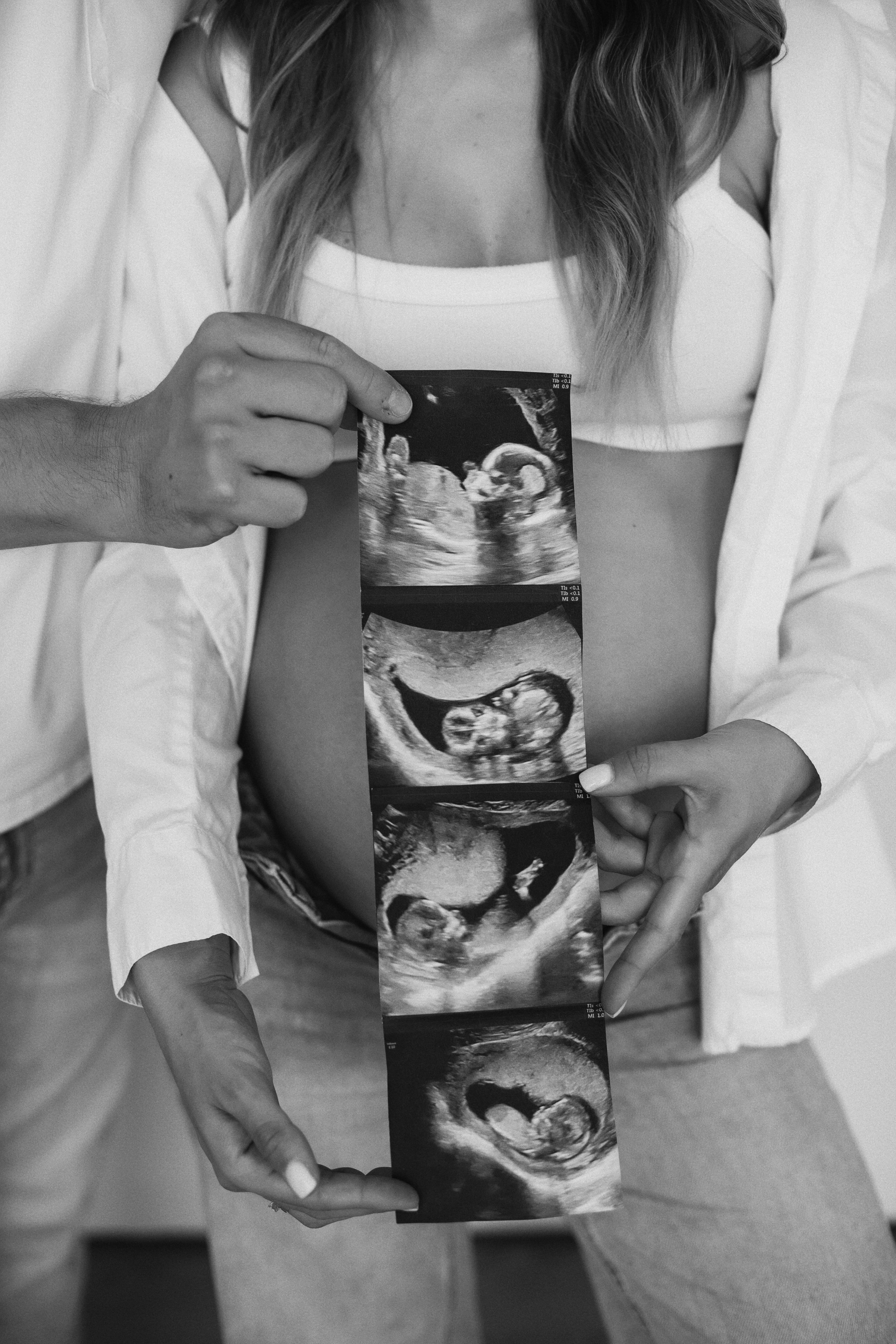 Maternity — photo 31 (B&W)
